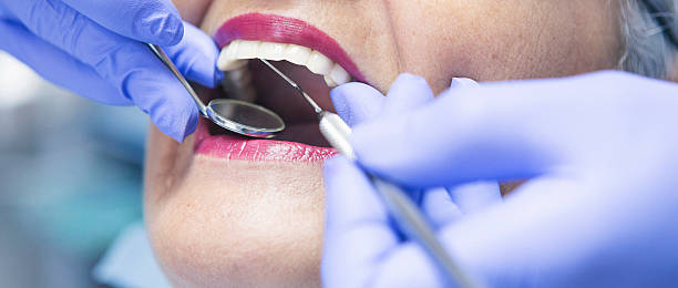 Best Emergency Dental Care for Abscessed Tooth in Calverton, NY